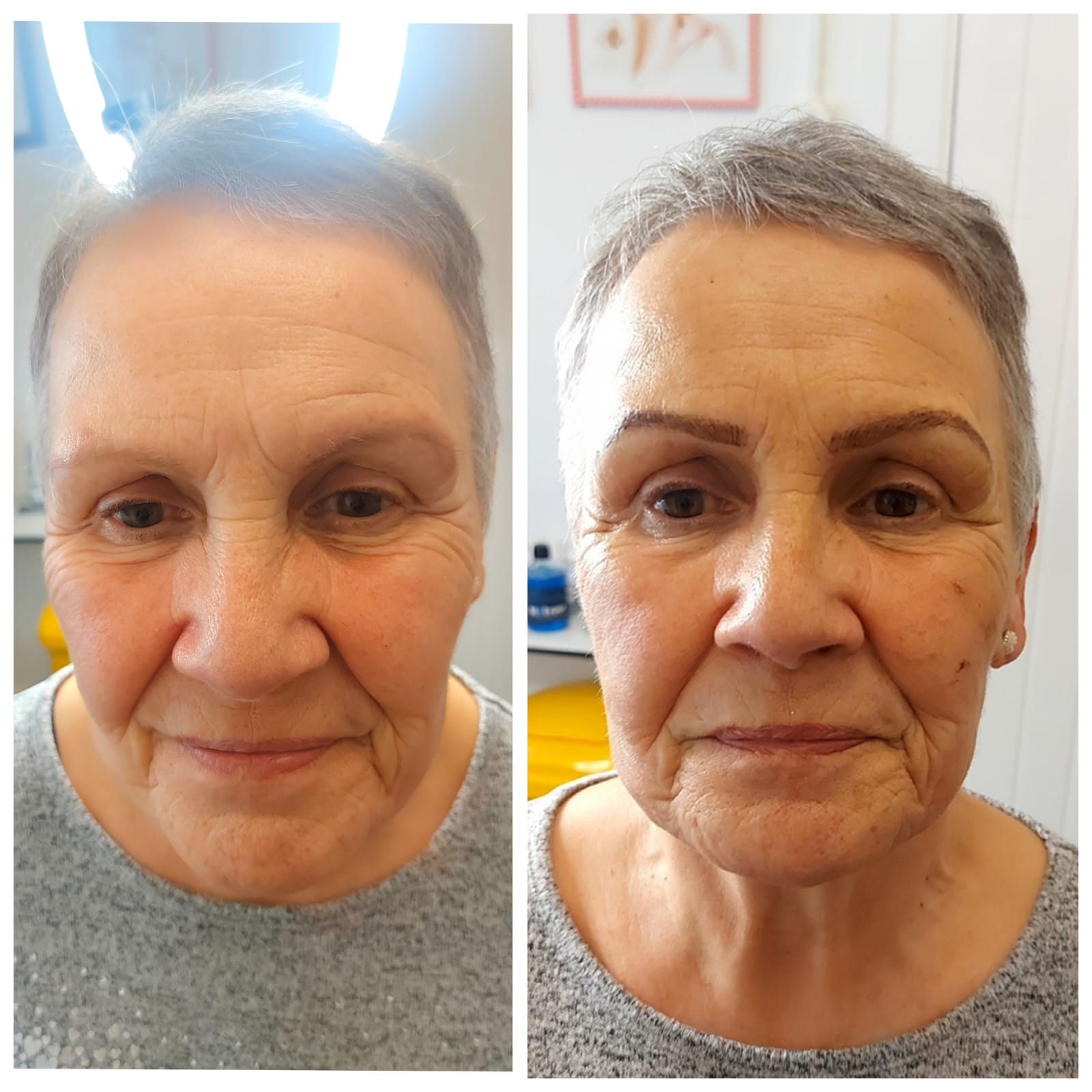 Before and after beauty treatment result by Little Beauty Secrets